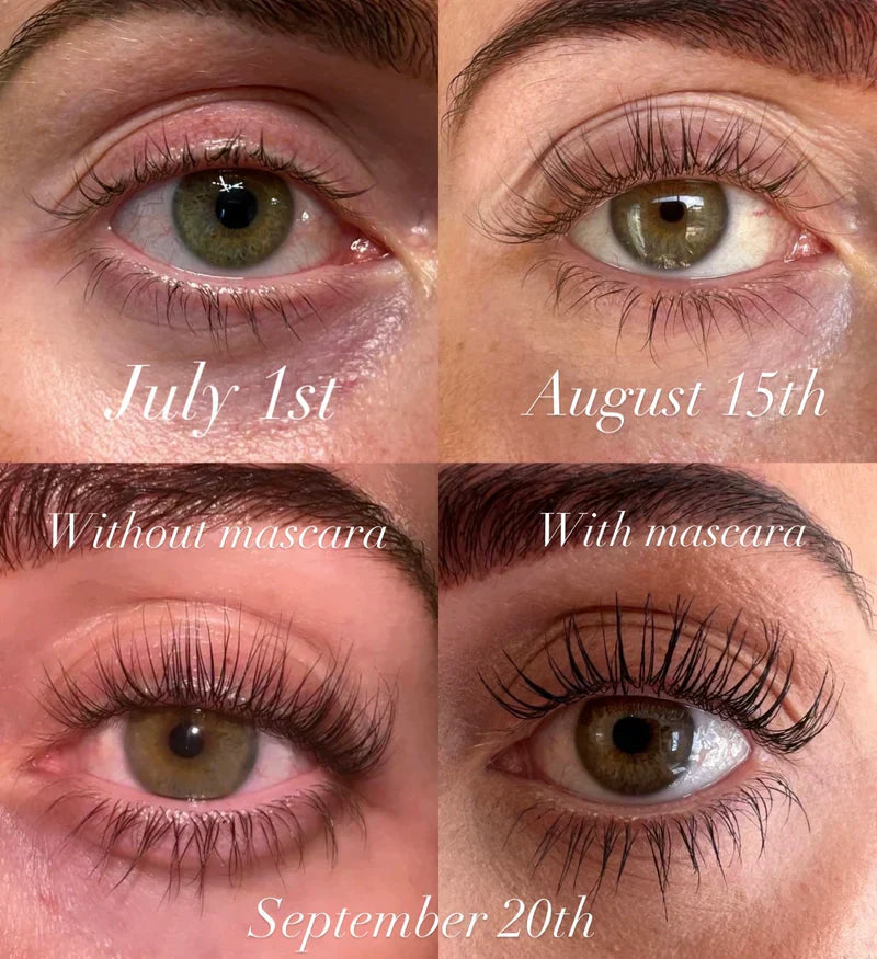 1+1 Gratis | Wimpernserum Geben Sie dünnen, kurzen Wimpern einen Schub