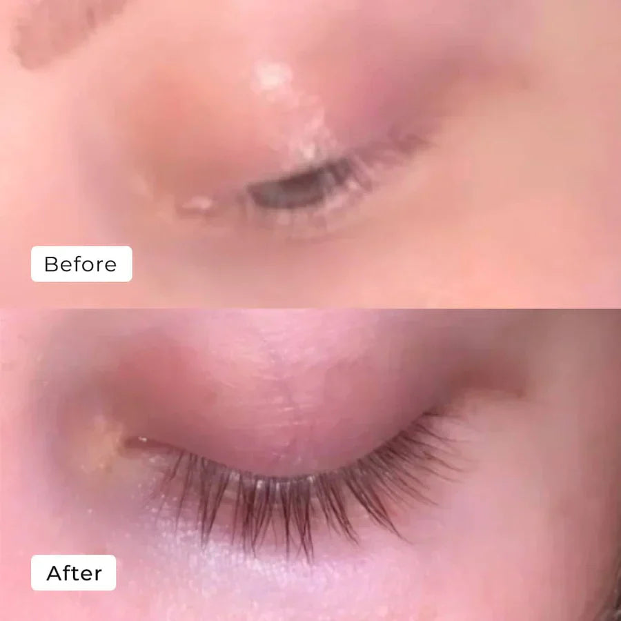 1+1 Gratis | Wimpernserum Geben Sie dünnen, kurzen Wimpern einen Schub