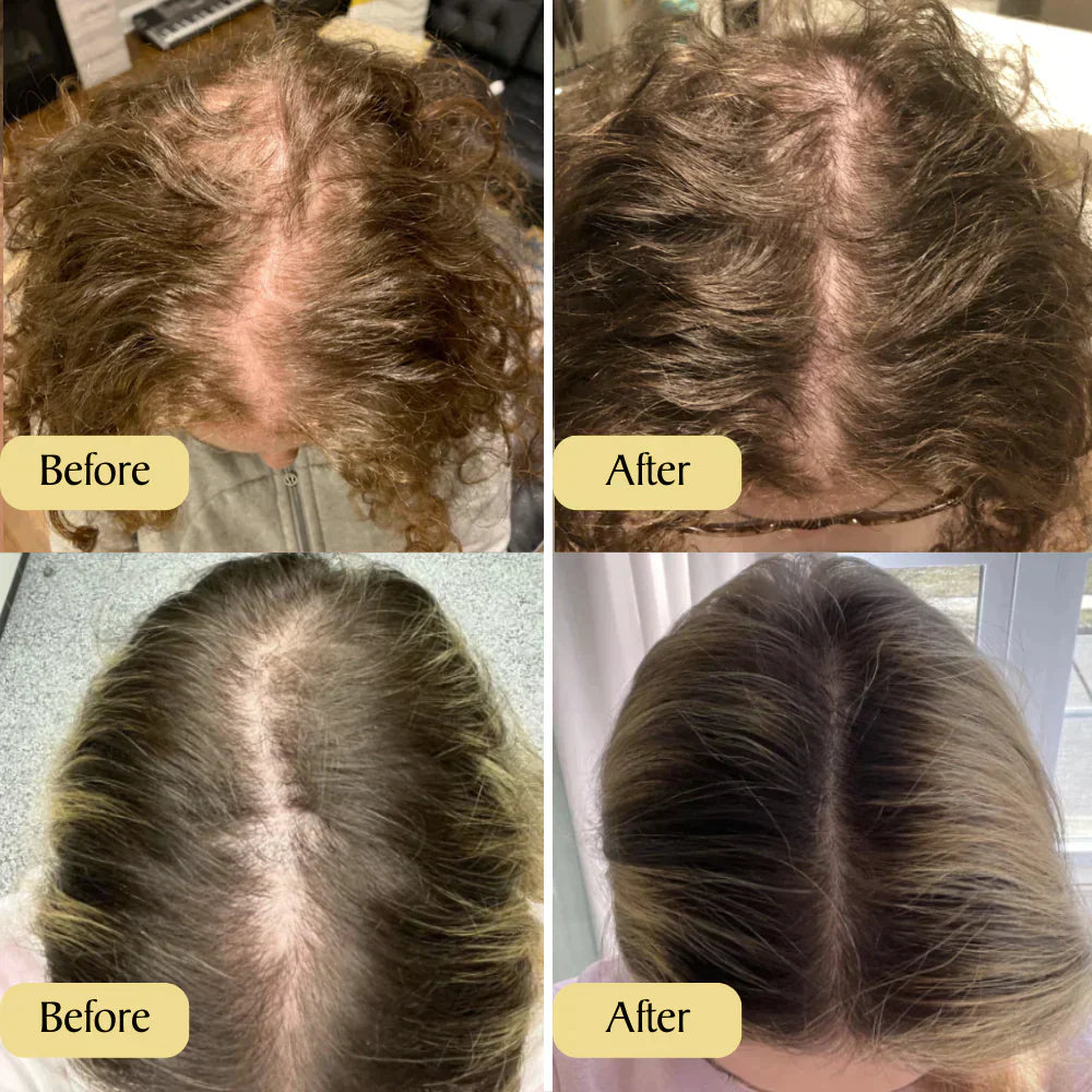 1+1 GRATIS | Carvenchy Deine natürliche Ölbehandlung für Haarwachastum