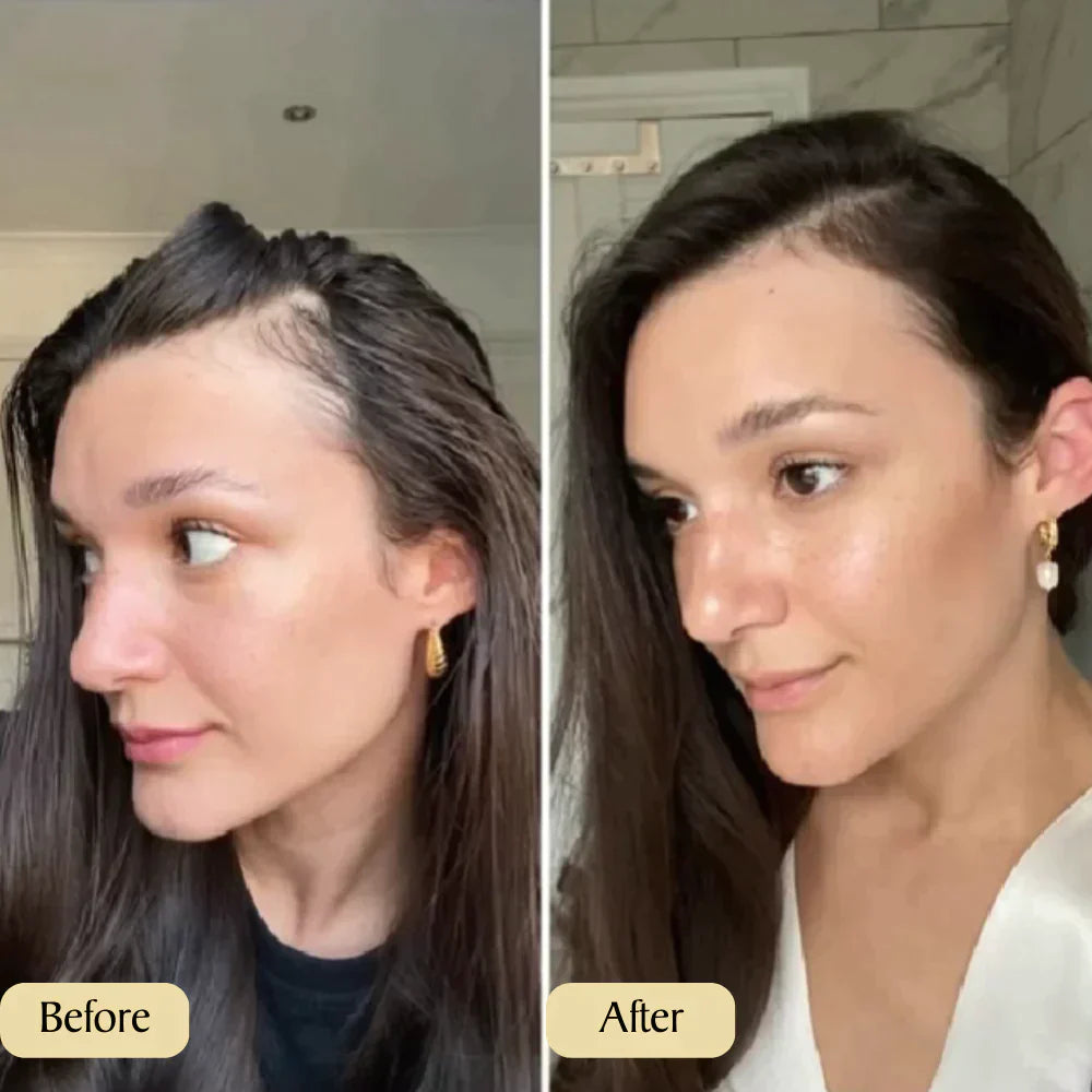 1+1 GRATIS | Carvenchy Deine natürliche Ölbehandlung für Haarwachastum