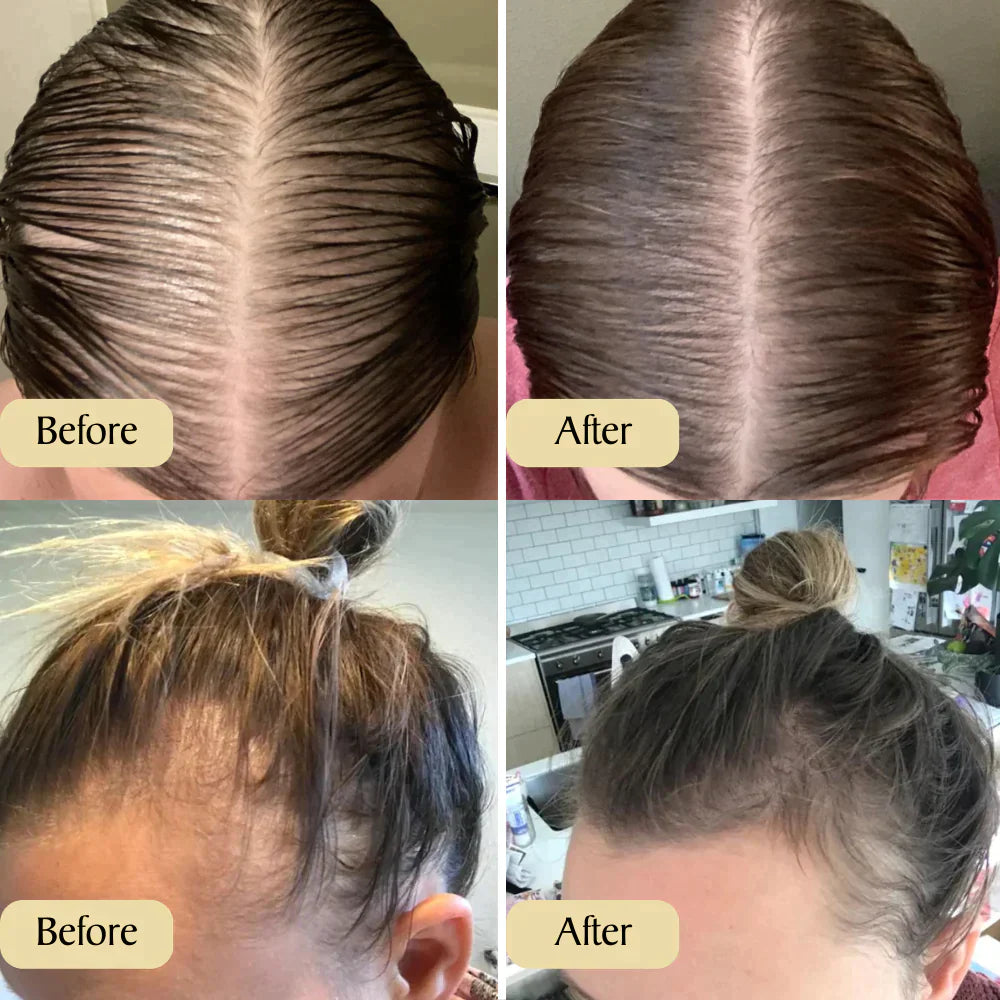 1+1 GRATIS | Carvenchy Deine natürliche Ölbehandlung für Haarwachastum